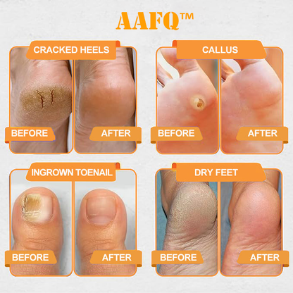 AAFQ™ Bee Venom Lymphatic Drainage & Slimming Foot SoakBeads【Doctorrecommendation-For alllymphatic problems and obesity】